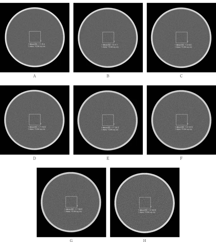 Fig. 2. The CT attenuation coefficient and noise measured of water on non-enhanced scanning in the reconstructed with a  kernel  type