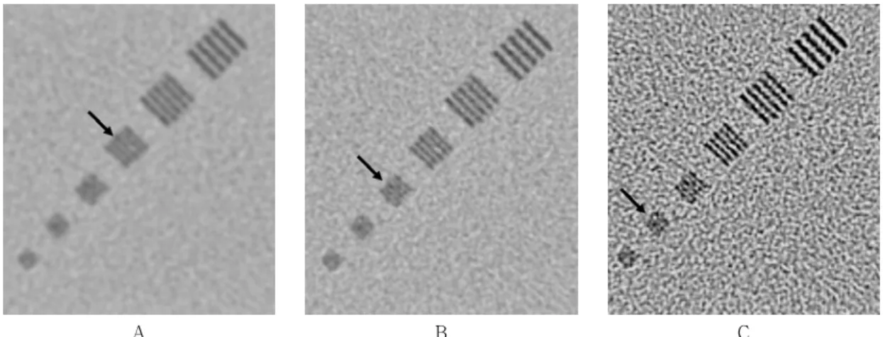 Fig. 8. Line-pair phantom scanned to 25 cm field of view by using B10(A), B40(B) and B80(C) kernels
