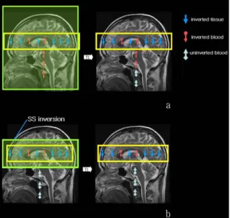Fig. 1. Positions of the imaging slice and the labeling sites  in pulsed ASL imaging. tagging PASL imaging(a), control  PASL imaging(b) the labeling can be placed on the spins  flowing