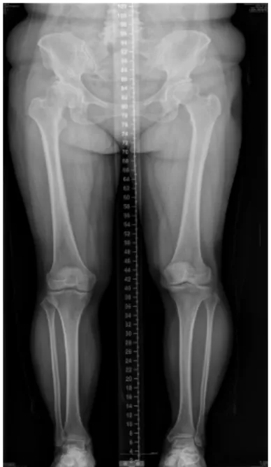 Fig.  4.  Lower  extremities  scanography  at  Nov  4th,  2019.