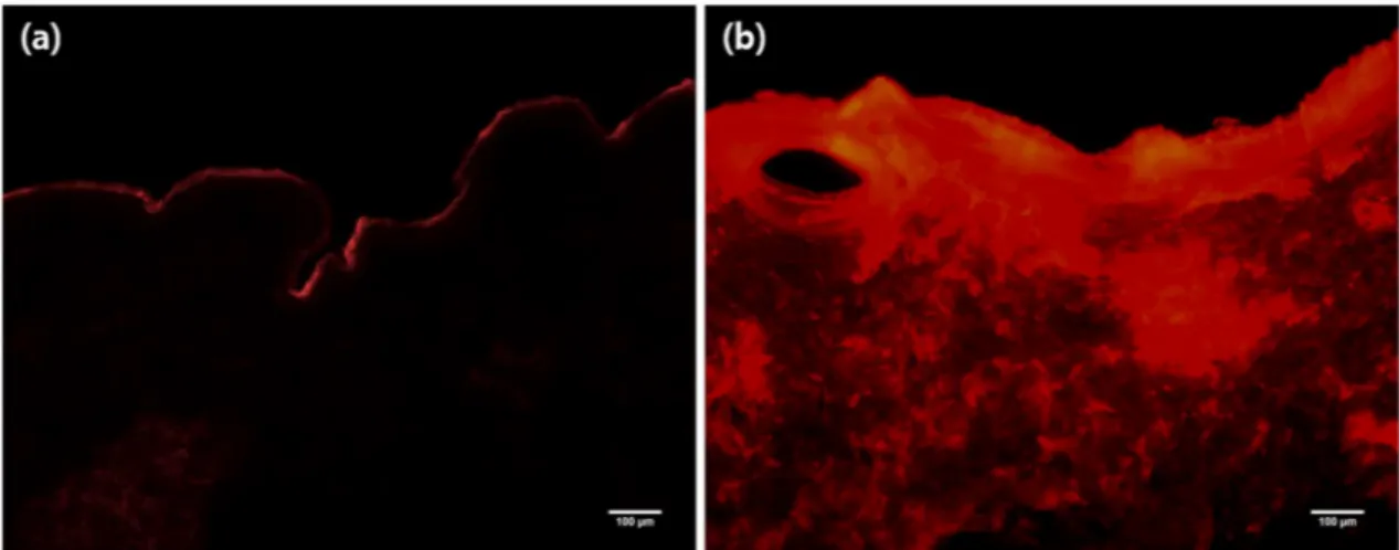 Figure  7.  Histological  images  of  cryosectioned  porcine  skin  after  SRB  dye  application