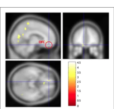 FIGURE 2 | Frontal polar cortex (−26, 50, −6) in the left hemisphere was significantly activated in the internal/controllable condition as contrasted to the external/uncontrollable condition.
