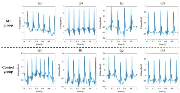 Figure 13. Normal ECG waveforms. 
