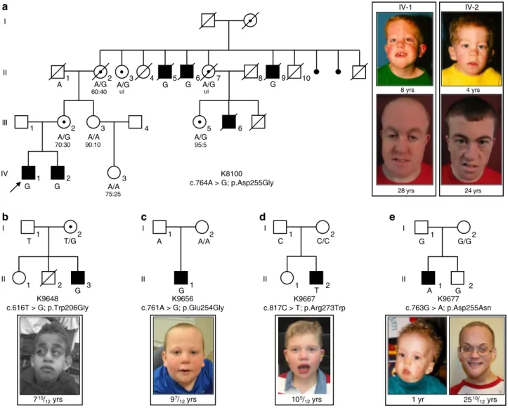 Fig. 1 Missense variants in FAM50A cause XLID in ﬁve unrelated families. a–e Pedigrees of the ﬁve families reported in this study are shown, with FAM50A genotype given for each available individual