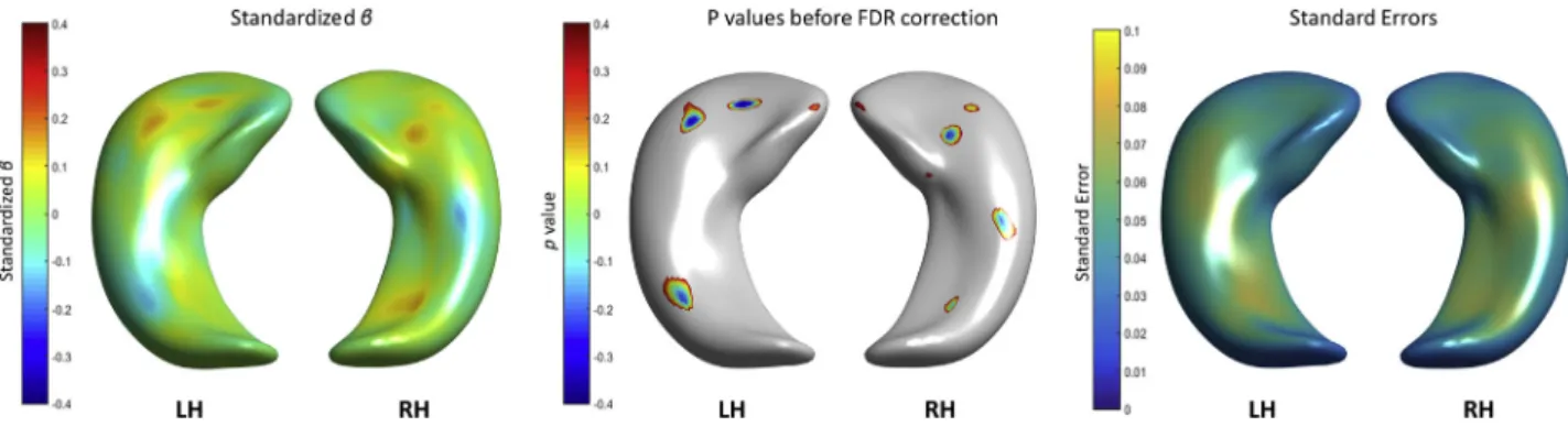 Fig. 6. Associations between hippocampal shape deformations and age 11 IQ (left), signiﬁcance (p-values) before correcting for multiple comparisons (middle) and standard errors (right)