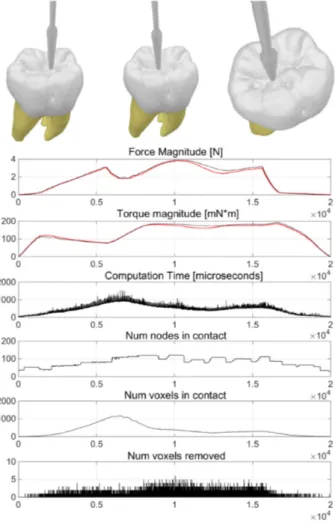 Fig. 6.  Simulation results on tooth cutting.