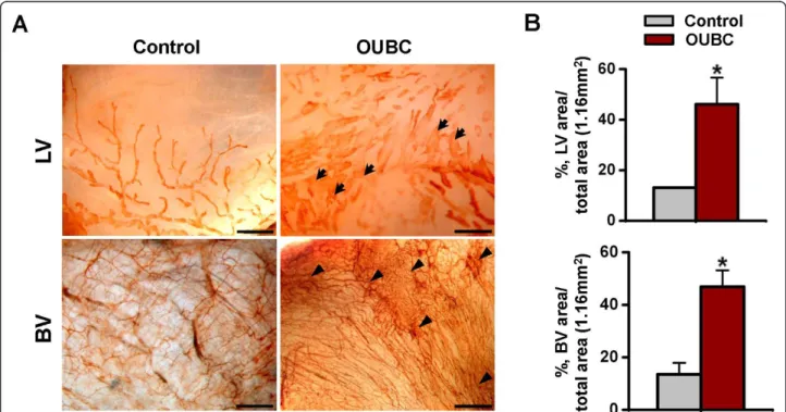 Figure 2 OUBC displays markedly increased number of lymphatic and blood vessels in the peritoneal surface of bladder wall