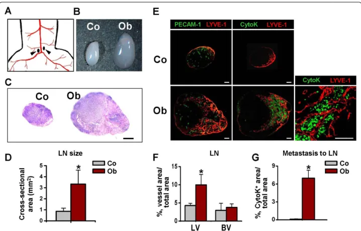 Figure 3 OUBC displays profound increases in sizes of SLN and metastatic spread of cancer cells to SLN