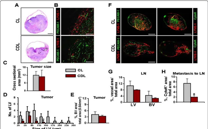 Figure 6 Depletion of CD11b + /CD68 + TAM reduced OUBC-induced lymphangiogenesis and lymphatic spread of bladder cancer cells