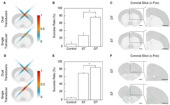 Fig. 3. Neuromodulation of motor cortex with dual and single ultrasound transducers. (A) Schematic of intensity proﬁles for the comparison between dual-crossed (DT) and single transducers (ST) for equal single beam intensities, resulting in a lower (halved