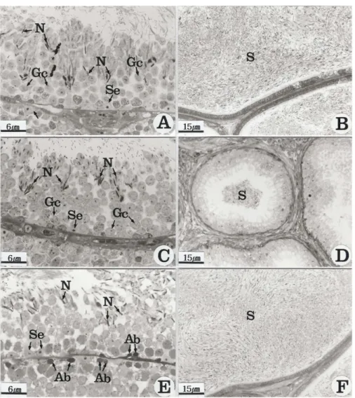 Fig. 1. Light micrographs of the reproductive organs in the striped field mice exposed to corn oil (A, B) and 4-t-octylphenol  800 mg/kg (OP800) (C, D, E, F)