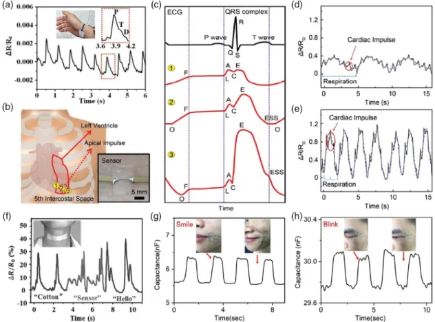 Figure 9. Low-strain applications of stretchable and highly sensitive strain sensors. a) The resistance change of a stretchable strain sensor with respect to the blood ﬂow pressure in the wrist