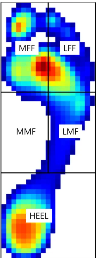 Fig 1. The dynamic pedobarograph was analyzed by dividing the plantar surface into five segments