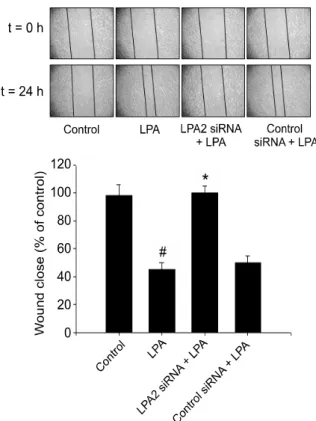 Figure  5.  LPA2 is involved in LPA-induced cell motility. The cells were 