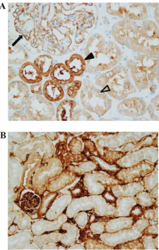 Figure 1. LOXL2 expression in human and mouse kidneys. Results of immu- immu-nohistochemistry revealed that LOXL2 expression is present in glomeruli  and tubular epithelial cells in the (A) human and (B) mouse kidney samples