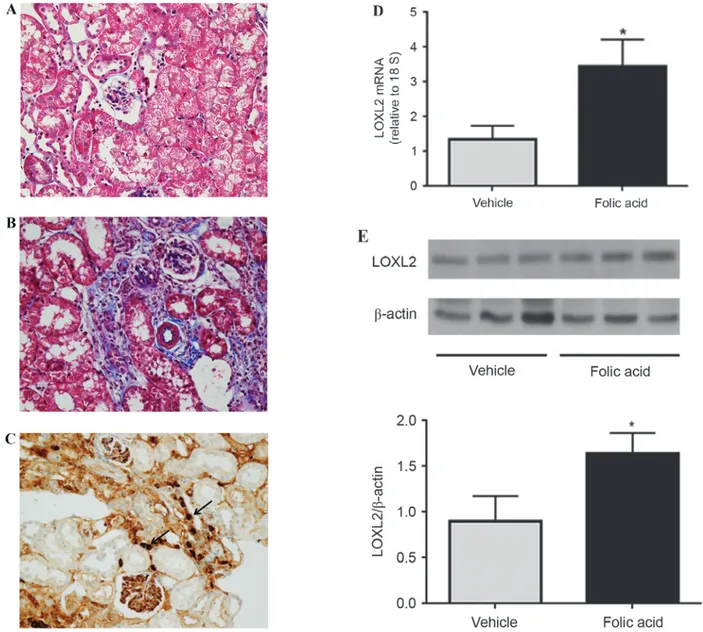 Figure 4. LOXL2 expression in a mouse model of tubulointerstitial fibrosis. Compared with in (A) vehicle‑treated control mice, (B) diffuse tubulointerstitial  fibrosis was induced 4 weeks after intraperitoneal injection of folic acid in CD1 mice