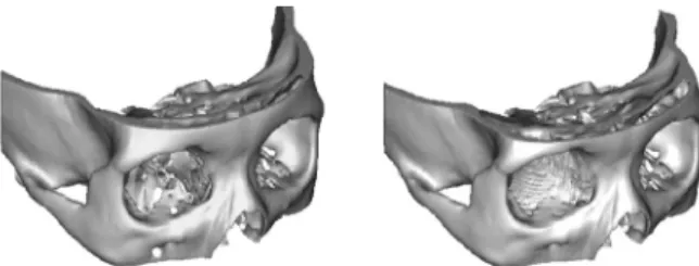 Fig. 2. Computer simulation based on the mirroring technique. 