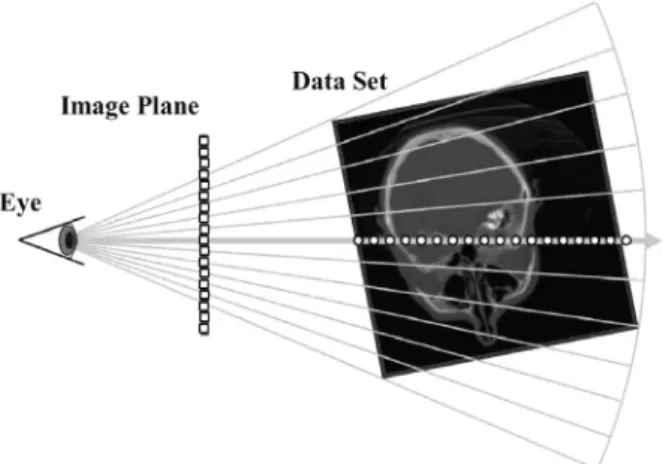 Fig. 1. 직접 볼륨 렌더링을 두개골 CT 영상에 적용해본 결과. Fig. 2. 직접 볼륨 렌더링에서는 이미지 각 필셀에서 볼륨으로부터 광선을 쏘아 광선이 지나는 각 점의 특징에 따라 색상을 결정한다
