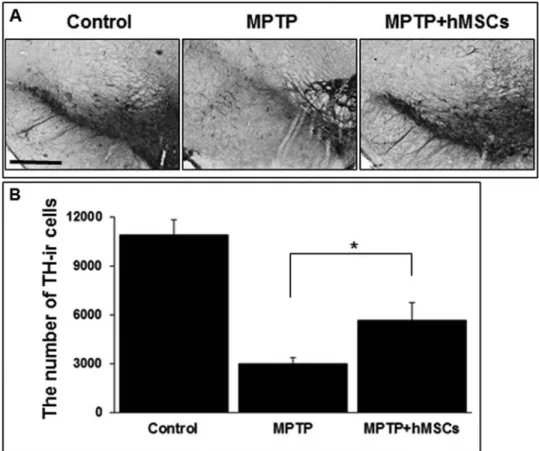 Figure 3. Effect of hMSCs on survival of dopaminergic neurons in MPTP-induced Parkinson’s dis-