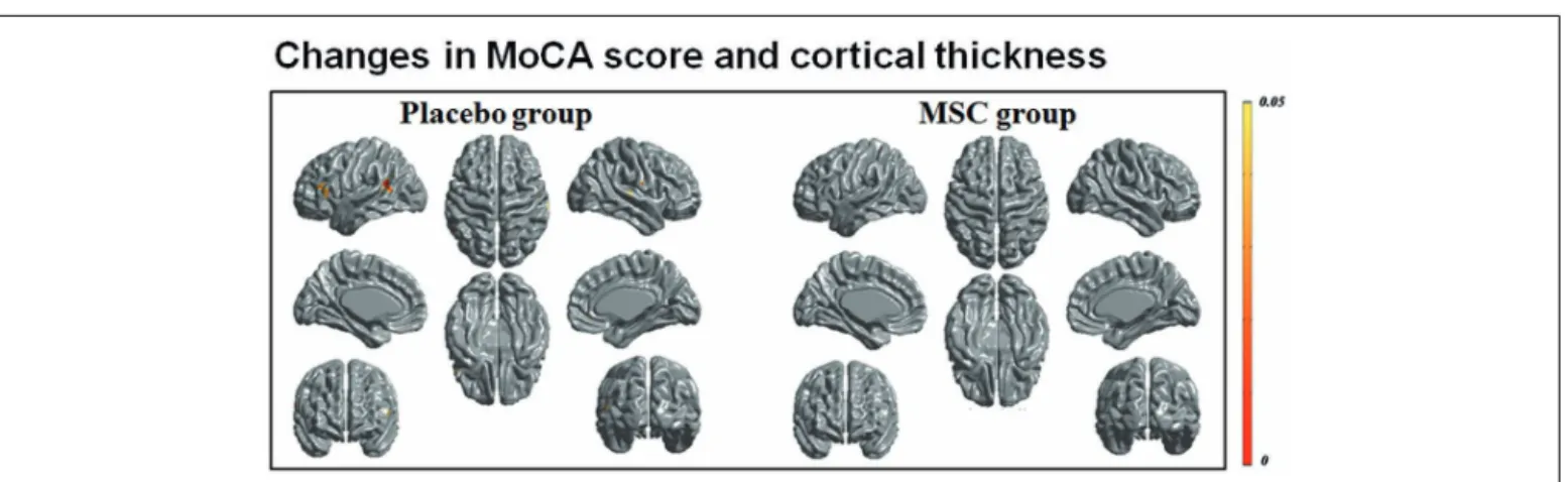 FIGURE 2 | Correlation analysis of longitudinal changes in cortical thinning and general cognition