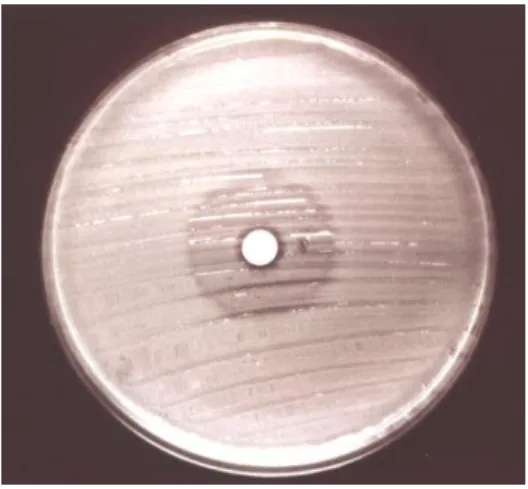 Fig.  2.  A  strain,  which  lost  part  of  MBL-producing  cells.  Large  number  of  MBL-producing  cells  grew  inside  the  inhibition  zone  produced  by  imipenem  disk,  but  mixed  appearance  is  apparent
