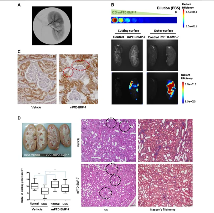 FIGURE 5 | Interventional administration of micellized PTD-BMP-7 (mPTD-BMP-7) via renal artery attenuates renal ﬁbrosis in pig unilateral ureter obstruction