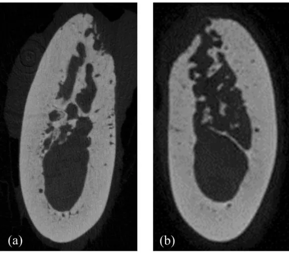 Fig.  7.  Representative  micro-CT  images  of  the  septal  bone  in  the  CON  animal