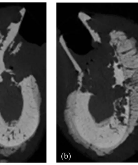 Fig. 9. Representative  micro-CT images of the  extraction socket  in the ZOL animal. (a) 