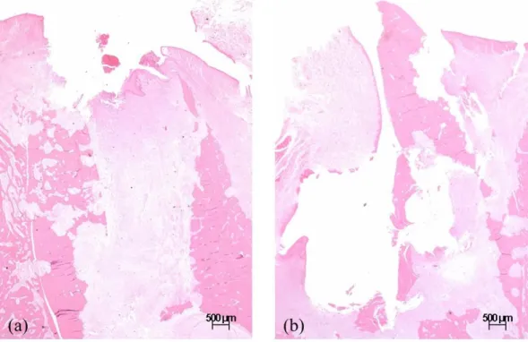 Fig.  10.  Representative  histologic  images  of  the  extraction  socket  in  the  ZOL  animal  (x1.25)