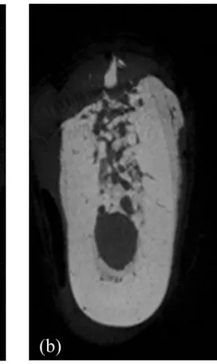 Fig.  11.  Representative  micro-CT  images  of  the  septal  bone  in  the  ZOL  animal