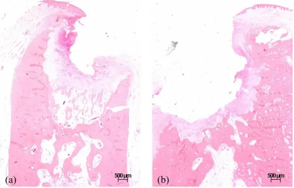Fig. 12. Representative histologic images of the septal bone in the ZOL animal (x1.25)