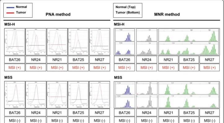Fig. 3 Analysis of MSI status in 166 CRCs and matched normal samples using PNA (left panel) and MNR method (right panel)