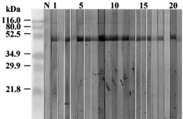 FIG. 5. IgE immunoblotting. Patients 2, 4, 17, 19, and 21 tested negative. Lanes: N, negative control; 1 to 21, sera of humans skin test positive to C