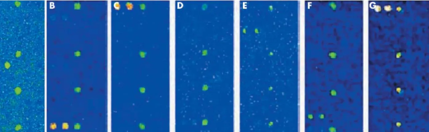 Figure 2 Western blot analysis of cell cycle regulatory proteins, cyclin B1, cdc2, and phosphorylated cdc2 in human cervical swab samples