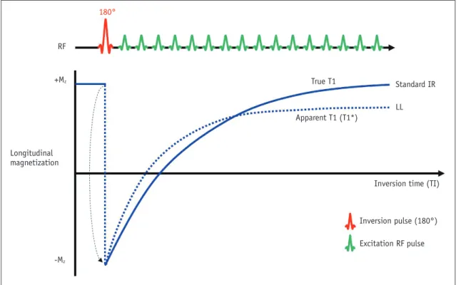 Fig. 2. Apparent T1* and true T1 recovery.  Comparison of longitudinal magnetization using standard inversion recovery and Look–Locker  (LL) T1 mapping methods