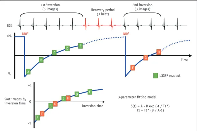 Fig. 3. Modified Look–Locker inversion recovery (MOLLI) with 5(3)3 protocol.  MOLLI method features several modifications intended  to improve accuracy and precision