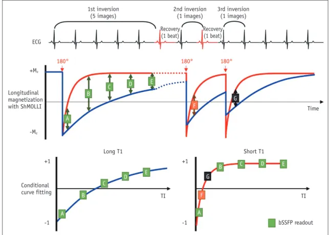 Fig. 4. Shortened modified Look–Locker inversion recovery (ShMOLLI).  ShMOLLI method employs conditional analysis algorithm that  can distinguish between short and long T1 values using curve-fitting errors and, therefore, features shorter scan time than or