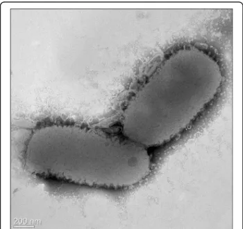 Figure 2 Transmission electron micrograph of Flavobacterium seoulense EM1321 T . Scale bar, 200 nm.