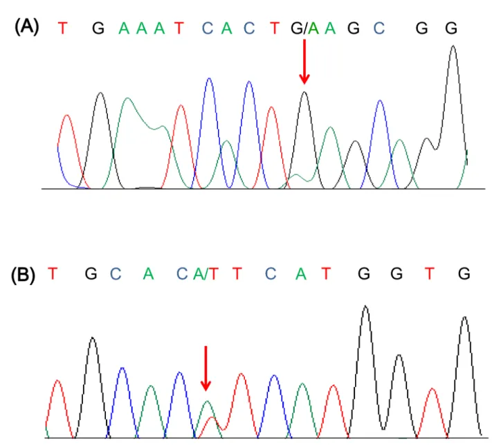 Figure 3: Representative sequence chromatogram of A.  E545K (G1634A) and B. H1047L (A3140T) mutation.