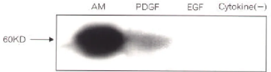 Fig. 5. Western blot analysis of tyrosine hydroxylase in neuronal cells dif- dif-ferentiated from neuronal stem cells