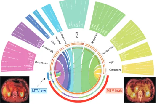 Fig. 8. Circos plot for the landscape  of discriminating gene expression  related to cancer-specific genes  ac-cording to metabolic phenotype in  resected pT3 pancreatic cancer