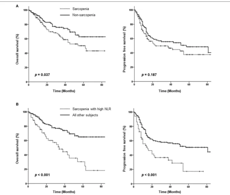 FIGURE 2 | Kaplan-Meier curves comparing overall and progression-free survival between the sarcopenia and non-sarcopenia groups (A) as well as between patients with sarcopenia plus a high neutrophil/lymphocyte ratio (NLR) and those without sarcopenia or a 