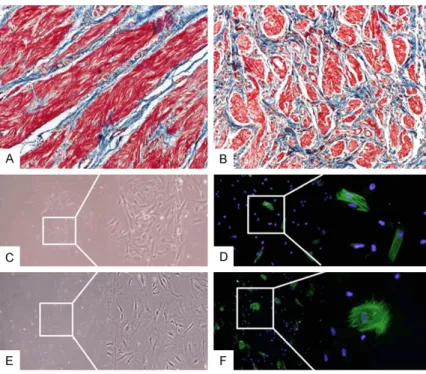 Figure 1. Fibrosis of megaureter tissues and α-smooth muscle actin staining  of primary cultured SMCs
