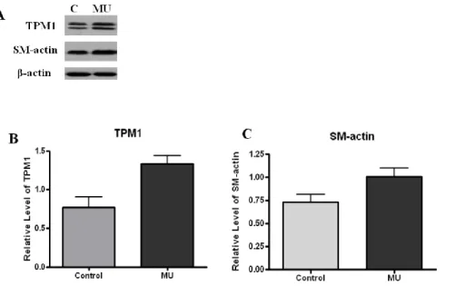 Figure 4. The differentially expressed TPM1 and  smooth muscle protein 