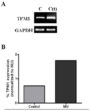 Figure  5.  Changes  in  TPM1  mRNA  level  in  transfected  SMCs.  RT-PCR 