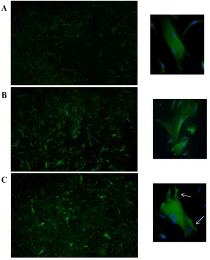 Figure 7. Representative photographs of immunocytochemical analysis of  TPM1  protein  expression