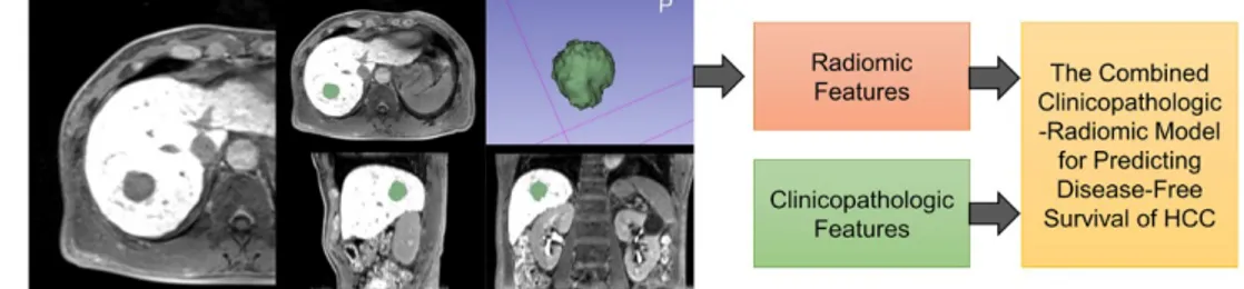 Figure  3.  Three  prognostic  models  for  predicting  disease-free  survival  in  hepatocellular carcinoma