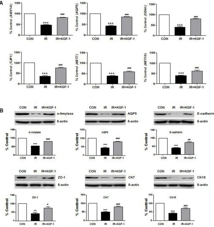 Figure 2: Effect of KGF-1 on salivary mRNA and protein expression.  (A) Irradiation significantly decreases the salivary acinar  markers (α-amylase; AMY1A and AQP5; AQP5), TJ protein (ZO-1; TJP1), adherence protein (E-cadherin; CDH1), and ductal markers  (