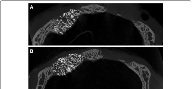 Fig. 5 Representative coronally sectioned micro-computed tomography images at 8 weeks postoperation