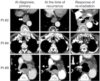 Fig. 1. Computed tomography images of at diagnosis (primary), 